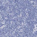 Acrosomal Vesicle Protein Antibody in Immunohistochemistry (IHC)