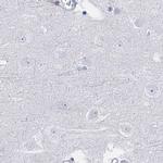 Acrosomal Vesicle Protein Antibody in Immunohistochemistry (IHC)