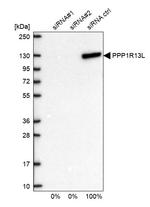 PPP1R13L Antibody in Western Blot (WB)