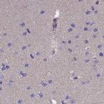 AMDHD2 Antibody in Immunohistochemistry (IHC)