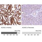 ACAA2 Antibody in Immunohistochemistry (IHC)