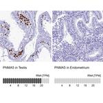 PNMA5 Antibody in Immunohistochemistry (IHC)