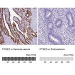 PTGES Antibody in Immunohistochemistry (IHC)