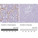 SLC23A1 Antibody in Immunohistochemistry (IHC)