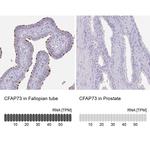 CCDC42B Antibody in Immunohistochemistry (IHC)