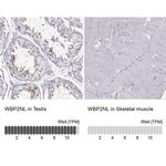 WBP2NL Antibody