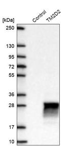 TM2D2 Antibody in Western Blot (WB)