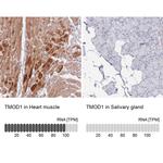 TMOD1 Antibody in Immunohistochemistry (IHC)
