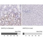 AdoHcyase 3 Antibody in Immunohistochemistry (IHC)