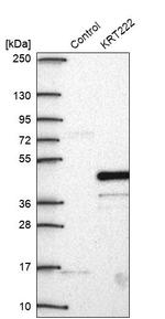 Krt222 Antibody in Western Blot (WB)
