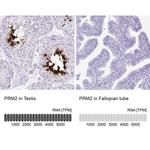 PRM2 Antibody in Immunohistochemistry (IHC)