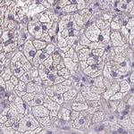 EPB41L1 Antibody in Immunohistochemistry (IHC)