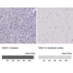 Granulysin Antibody in Immunohistochemistry (IHC)