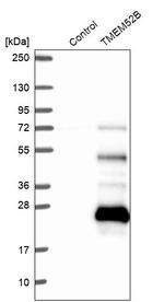 TMEM52B Antibody in Western Blot (WB)