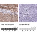LIMS2 Antibody in Immunohistochemistry (IHC)