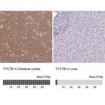 TTC7B Antibody in Immunohistochemistry (IHC)