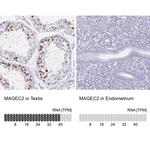 MAGEC2 Antibody in Immunohistochemistry (IHC)