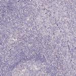 SNIP Antibody in Immunohistochemistry (IHC)