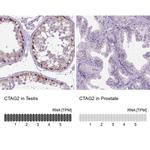 CTAG2 Antibody in Immunohistochemistry (IHC)