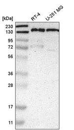 PPFIA1 Antibody in Western Blot (WB)