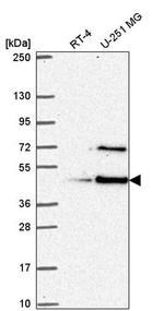 LUC7L Antibody in Western Blot (WB)