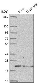DCTN5 Antibody in Western Blot (WB)
