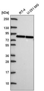 OATP1 Antibody in Western Blot (WB)