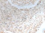 ZNF238 Antibody in Immunohistochemistry (Paraffin) (IHC (P))