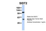 SIDT2 Antibody in Western Blot (WB)