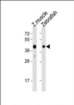 ADRA2DB Antibody in Western Blot (WB)