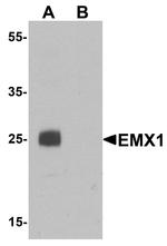 EMX1 Antibody in Western Blot (WB)