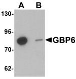 GBP6 Antibody in Western Blot (WB)