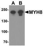 MYH8 Antibody in Western Blot (WB)