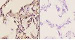 ETV6 Antibody in Immunohistochemistry (Paraffin) (IHC (P))