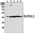 ELOVL1 Antibody in Western Blot (WB)