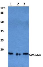COX7A2L Antibody in Western Blot (WB)