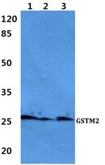 GSTM2 Antibody in Western Blot (WB)