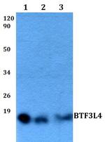 BTF3L4 Antibody in Western Blot (WB)