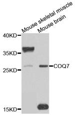 COQ7 Antibody in Western Blot (WB)