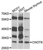CNOT8 Antibody in Western Blot (WB)
