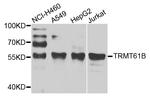 TRMT61B Antibody in Western Blot (WB)