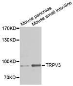 TRPV3 Antibody in Western Blot (WB)