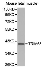 MURF1 Antibody in Western Blot (WB)
