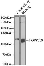 TRAPPC10 Antibody in Western Blot (WB)