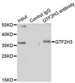 GTF2H3 Antibody in Immunoprecipitation (IP)