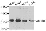 GTF2H3 Antibody in Western Blot (WB)
