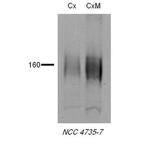 SLC12A3 Antibody in Western Blot (WB)