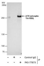 Phospho-ATR (Thr1989) Antibody in Immunoprecipitation (IP)