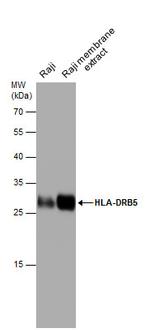 HLA-DRB5 Antibody in Western Blot (WB)