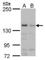 JARID2 Antibody in Western Blot (WB)